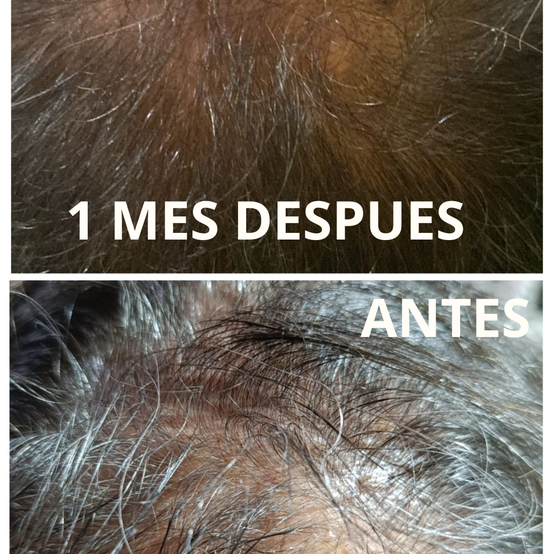 tratamiento capilar